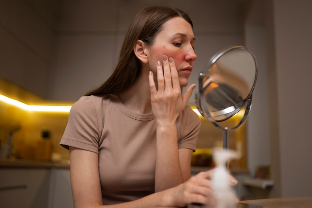 Skincare Tips for Acne-Prone Skin - Preventing Breakouts and Achieving Clear Skin